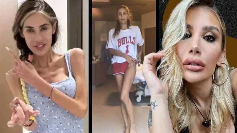 İrem Derici'den Nihal Candan'a Veda: Anoreksiya ile Zorlu Savaş!