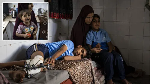 Gazze'de çocuk olmak: Hafızasını kaybetti kardeşi yürüyemez oldu