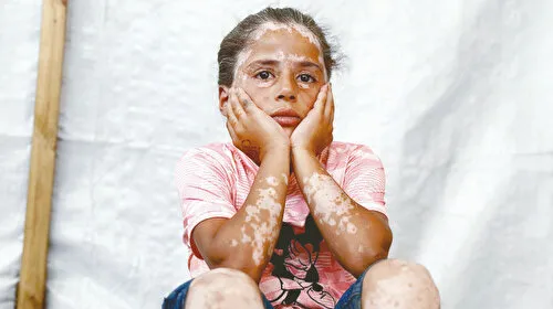 Gazze'de Savaşın İzleri: 10 Yaşındaki Lana'nın Dramı!