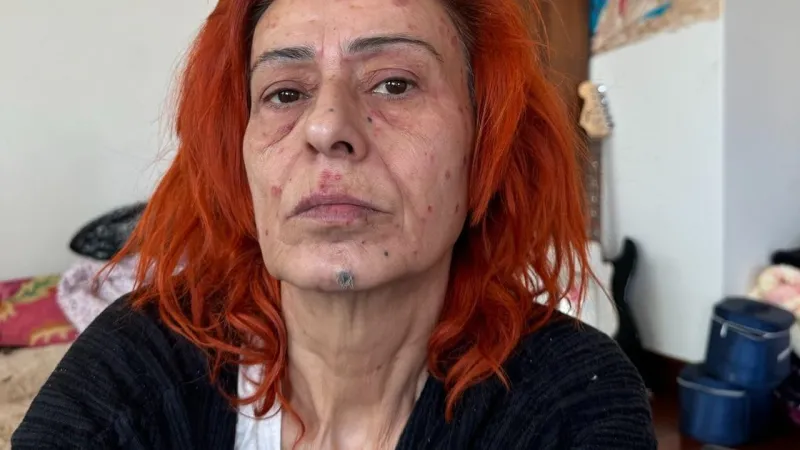 Yıldız Tilbe İsyan Etti: “Ne Yaşarken Ne Ölünce Anlatılamam''